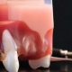 اهمیت نگهداری ایمپلنت دندان